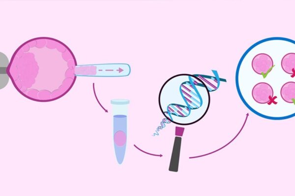 PGD en la FIV: ¿por qué y para qué es importante?
