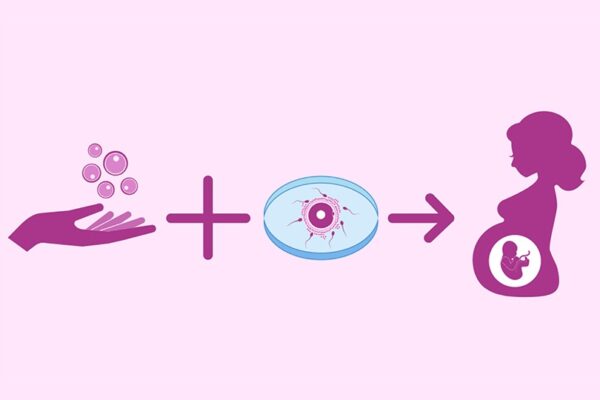 FIV con óvulos donados: cuándo es la única oportunidad de ser padres